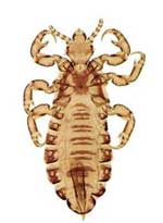 lice facts for kids lice pest information for students types of lice